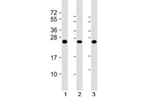 Western blot testing of human 1) A431, 2) HL-60 and 3) U2OS cell lysate with RAB5C antibody at 1:2000. (Rab5c antibody)