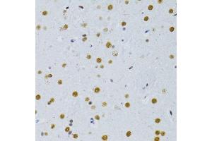 Immunohistochemistry of paraffin-embedded rat brain using SNRNP70 antibody. (SNRNP70 antibody  (AA 150-250))