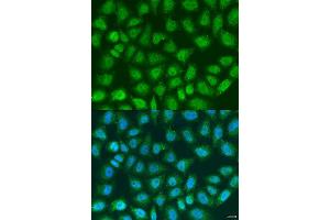 Immunofluorescence analysis of U2OS cells using SOCS4 antibody. (SOCS4 antibody  (AA 1-270))
