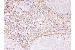 IHC analysis of Cyclophilin B using anti-Cyclophilin B antibody . (PPIB antibody  (AA 158-216))