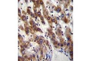 Immunohistochemistry analysis in formalin fixed and paraffin embedded human liver tissue reacted with PHF20 Antibody (N-term) followed which was peroxidase conjugated to the secondary antibody and followed by DAB staining. (PHF20 antibody  (N-Term))