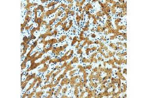 anti-Retinol Binding Protein 4, Plasma (RBP4) (AA 19-201) antibody