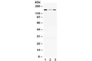Western blot testing of 1) rat brain, 2) mouse liver and 3) human HepG2 lysate with ADAMTS13 antibody at 0. (ADAMTS13 antibody)