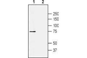 Kv1.4 antibody  (1st Extracellular Loop)