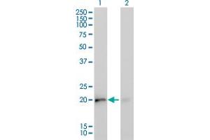 Western Blot analysis of KRAS expression in transfected 293T cell line by KRAS monoclonal antibody (M02), clone 4F3. (K-RAS antibody  (AA 16-125))