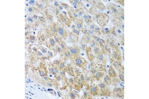 Immunohistochemistry of paraffin-embedded human liver using UBE2U antibody (ABIN6130858, ABIN6149825, ABIN6149826 and ABIN6224418) at dilution of 1:100 (40x lens). (UBE2U antibody  (AA 1-226))