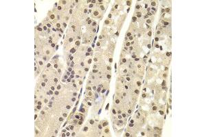 Immunohistochemistry of paraffin-embedded Human gastric using DNTT antibody at dilution of 1:100 (x400 lens). (TdT antibody)