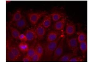 Image no. 2 for anti-VEGF Receptor 2 (VEGFR2) (Tyr1175) antibody (ABIN197236)