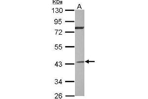 WB Image Sample (30 ug of whole cell lysate) A: Jurkat 10% SDS PAGE antibody diluted at 1:2000