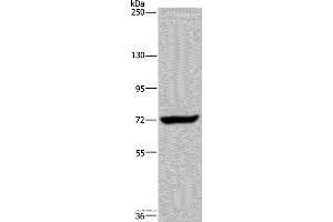 Western blot analysis of K562 cell, using ZC3H12A Polyclonal Antibody at dilution of 1:200 (ZC3H12A antibody)