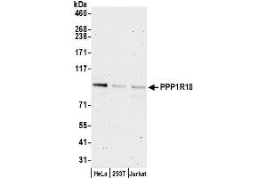 Western Blotting (WB) image for anti-KIAA1949 (KIAA1949) (AA 375-425) antibody (ABIN7452799)