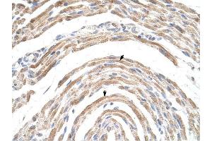 CPSF6 antibody was used for immunohistochemistry at a concentration of 16. (CPSF6 antibody  (Middle Region))