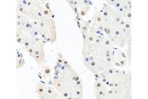 Immunohistochemistry of paraffin-embedded Human stomach using CHRAC1 Polyclonal Antibody at dilution of 1:100 (40x lens). (CHRAC1 antibody)