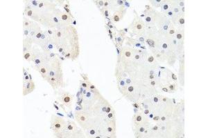 Immunohistochemistry of paraffin-embedded Human stomach using CHRAC1 Polyclonal Antibody at dilution of 1:100 (40x lens).