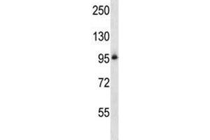 Integrin beta 5 antibody western blot analysis in NCI-H460 lysate. (Integrin beta 5 antibody  (AA 216-244))