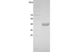 Western Blotting (WB) image for Plasminogen Activator Inhibitor 1 (SERPINE1) (AA 24-402) protein (His tag) (ABIN7281658) (PAI1 Protein (AA 24-402) (His tag))