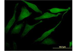 Immunofluorescence of monoclonal antibody to ACSS2 on HeLa cell. (ACSS2 antibody  (AA 32-130))