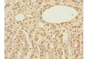 Immunohistochemistry of paraffin-embedded human adrenal gland tissue using ABIN7152155 at dilution of 1:100 (EIF3F antibody  (AA 88-357))