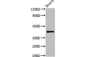 Western Blot Positive WB detected in: Rat brain tissue All lanes: METAP1 antibody at 6.