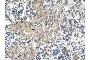 RRP1 antibody was used for immunohistochemistry at a concentration of 4-8 ug/ml to stain Epithelial cells of renal tubule (arrows) in Human Kidney.