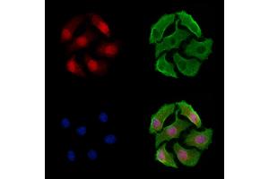 ABIN7093407 and ABIN7097429 staining Hela cells by IF/ICC. (CRTC2 antibody)
