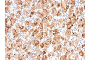 Formalin-fixed, paraffin-embedded human Thyroid stained with Thyroglobulin Mouse Recombinant Monoclonal Antibody (r2H11). (Recombinant Thyroglobulin antibody)