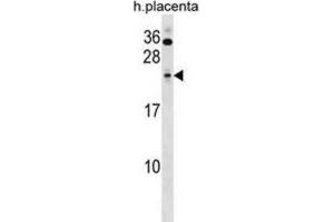 Western Blotting (WB) image for anti-Sin3A-Associated Protein, 30kDa (SAP30) antibody (ABIN2999173)