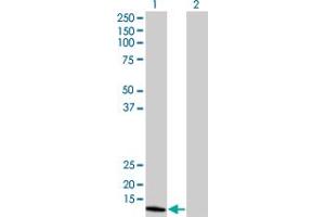 Western Blot analysis of NUDT1 expression in transfected 293T cell line by NUDT1 monoclonal antibody (M02), clone 5F11.