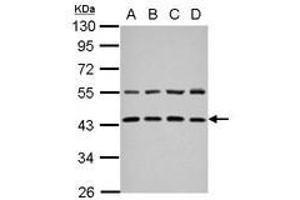 Image no. 1 for anti-Zinc Finger, FYVE Domain Containing 27 (ZFYVE27) (AA 166-411) antibody (ABIN1501822) (ZFYVE27 antibody  (AA 166-411))