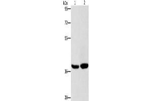 Gel: 8 % SDS-PAGE, Lysate: 40 μg, Lane 1-2: Human fetal brain tissue, 231 cells, Primary antibody: ABIN7128713(CAB39L Antibody) at dilution 1/400, Secondary antibody: Goat anti rabbit IgG at 1/8000 dilution, Exposure time: 15 seconds