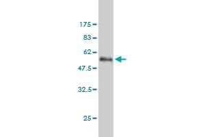 Western Blot detection against Immunogen (51. (SCNM1 antibody  (AA 1-230))
