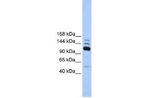 POLR3B antibody used at 1 ug/ml to detect target protein. (POLR3B antibody  (C-Term))