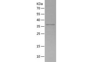 GOLPH3 Protein (AA 1-298) (His tag)