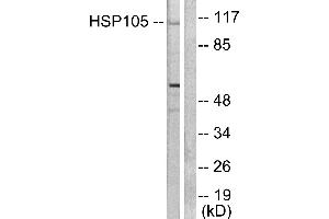 Western blot analysis of extracts from HeLa cells, using HSP105 antibody (#C0231).