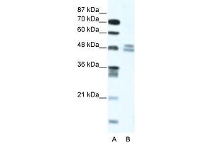 WB Suggested Anti-TRIAntibody Titration:  5. (TRIP13 antibody  (N-Term))