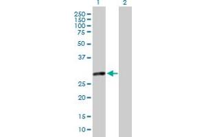 Western Blot analysis of MMS19 expression in transfected 293T cell line by MMS19 MaxPab polyclonal antibody. (MMS19 antibody  (AA 1-293))
