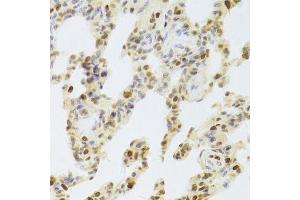 Immunohistochemistry of paraffin-embedded rat lung using HDGF Antibody.