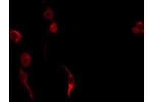 ABIN6275691 staining K562 by IF/ICC. (ZNF420 antibody  (Internal Region))