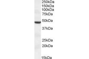 Image no. 1 for anti-Transmembrane Protease, serine 4 (TMPRSS4) (AA 243-255) antibody (ABIN490516) (TMPRSS4 antibody  (AA 243-255))