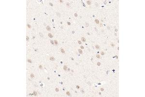 Immunohistochemistry analysis of paraffin embedded rat brain using ZNF771 (ABIN7076273) at dilution of 1: 600 (ZNF771 antibody)
