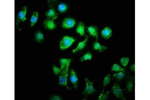 Immunofluorescence staining of A549 cells with ABIN7166328 at 1:133, counter-stained with DAPI. (WWC2 antibody  (AA 828-1127))