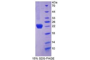 SDS-PAGE (SDS) image for Collagen, Type VI, alpha 1 (COL6A1) (AA 816-1002) protein (His tag) (ABIN1170123) (COL6A1 Protein (AA 816-1002) (His tag))