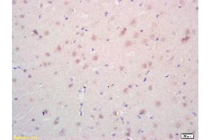 Formalin-fixed and paraffin embedded rat brain labeled with Rabbit Anti phospho-Androgen Receptor(Ser578) Polyclonal Antibody, Unconjugated (ABIN730123) at 1:200 followed by conjugation to the secondary antibody and DAB staining (Androgen Receptor antibody  (pSer578))