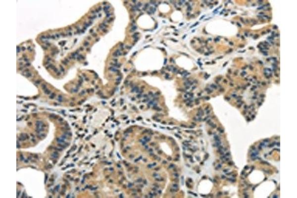 WDR36 antibody
