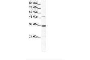 Image no. 1 for anti-Zinc Finger Protein 610 (ZNF610) (AA 70-119) antibody (ABIN6736026)
