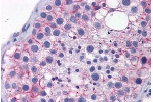 Human Testis: Formalin-Fixed, Paraffin-Embedded (FFPE) (TJP1 antibody  (AA 935-984))