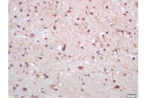 Formalin-fixed and paraffin embedded rat brain labeled with Anti Prostatic Acid Phosphatase Polyclonal Antibody (ABIN716996), Unconjugated at 1:200, followed by conjugation to the secondary antibody and DAB staining (ACPP antibody  (AA 21-120))