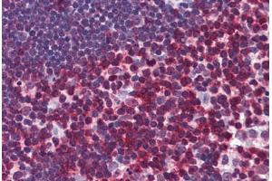 Human Thymus: Formalin-Fixed, Paraffin-Embedded (FFPE) (CD247 antibody  (AA 1-165))