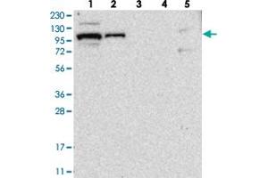 Western blot analysis of Lane 1: RT-4, Lane 2: U-251 MG, Lane 3: Human Plasma, Lane 4: Liver, Lane 5: Tonsil with BICD2 polyclonal antibody . (BICD2 antibody)