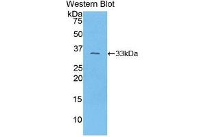 Detection of Recombinant COL1a1, Mouse using Polyclonal Antibody to Collagen Type I Alpha 1 (COL1a1) (COL1A1 antibody  (AA 1225-1453))